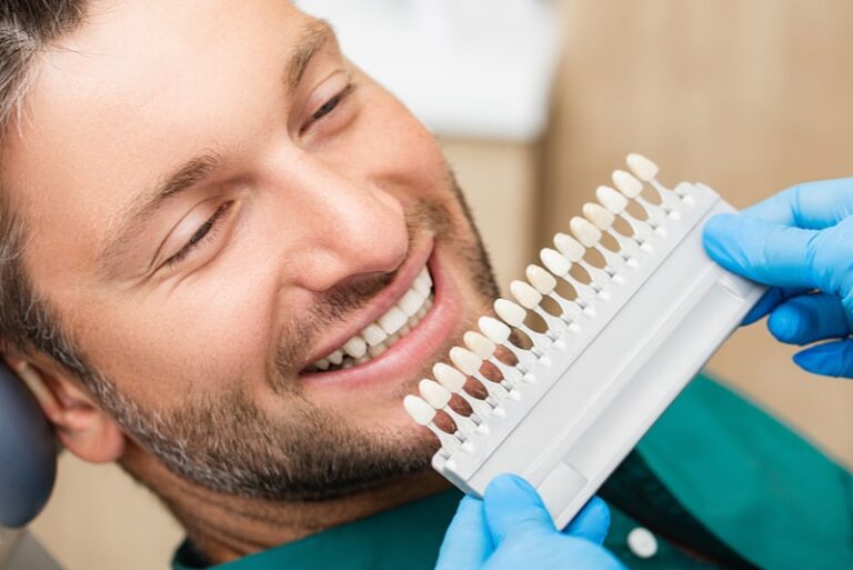 Top 10 Clinics for Veneers in London When Only Part of a Set Needs Replacing